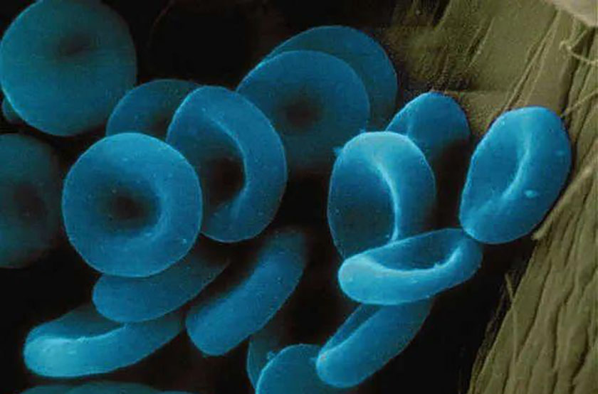 血藍蛋白加上CD-34免疫幹細胞激活劑，成功産生特定B肝病毒抗體的機率有多高？ ...